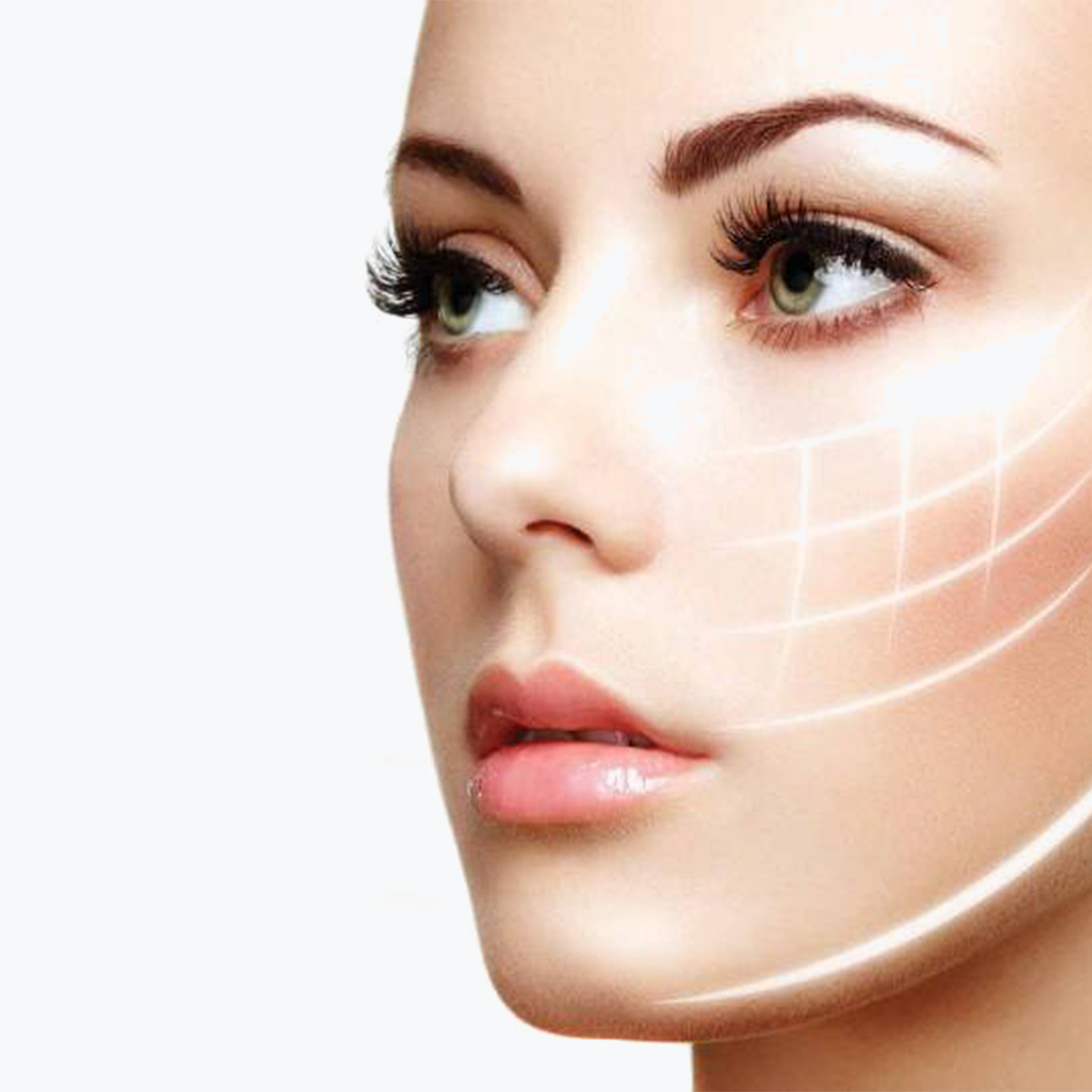 ร้อยไหม (Mini Face lift)